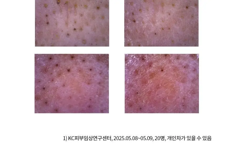 [스킨케어링] 비페스타 클렌징오일 3종 (세럼/브라이트닝/딥클리어) 상세페이지 13